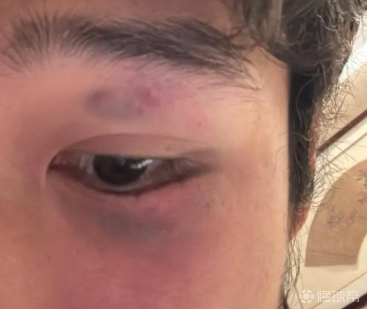  《一场意外，一份从容：足球场上的温暖与力量》 体育新闻